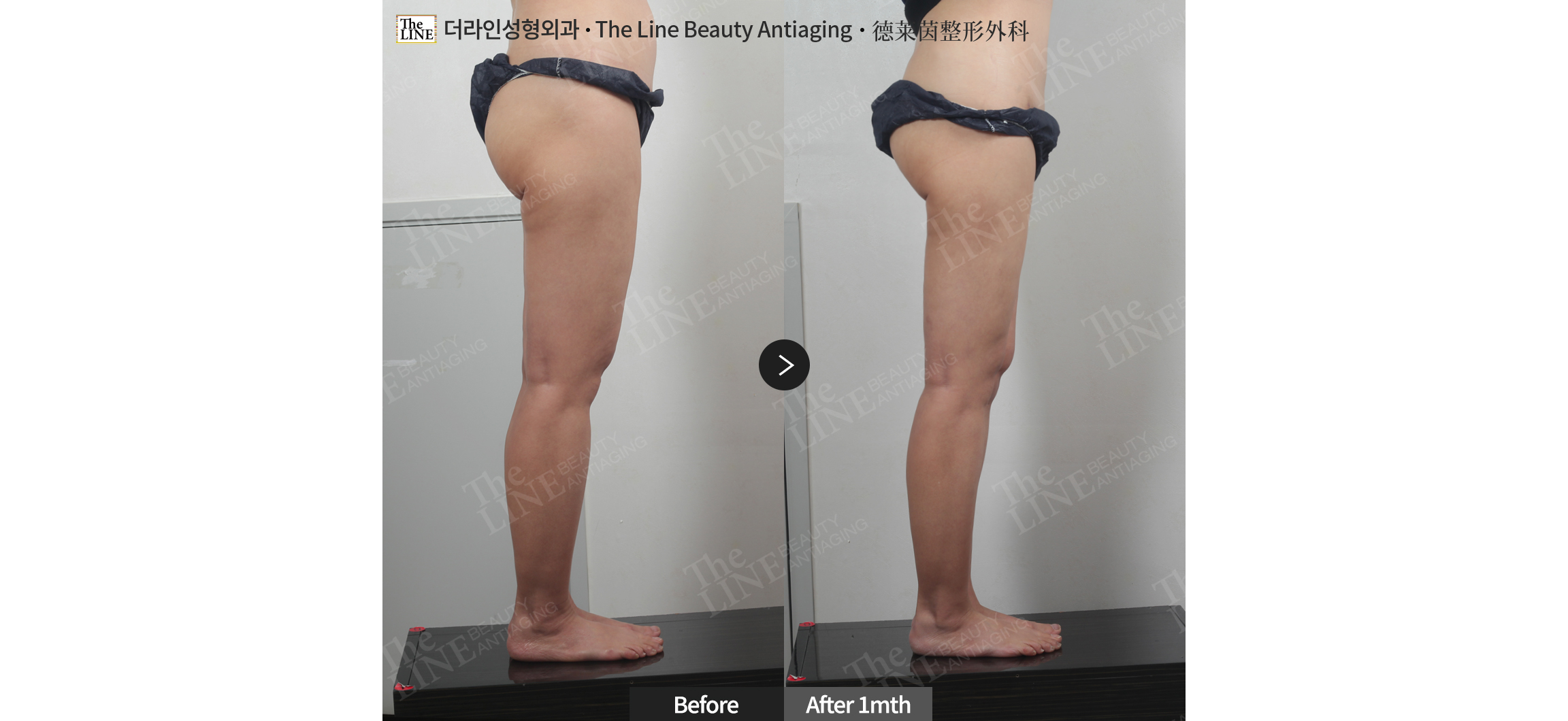 전사진