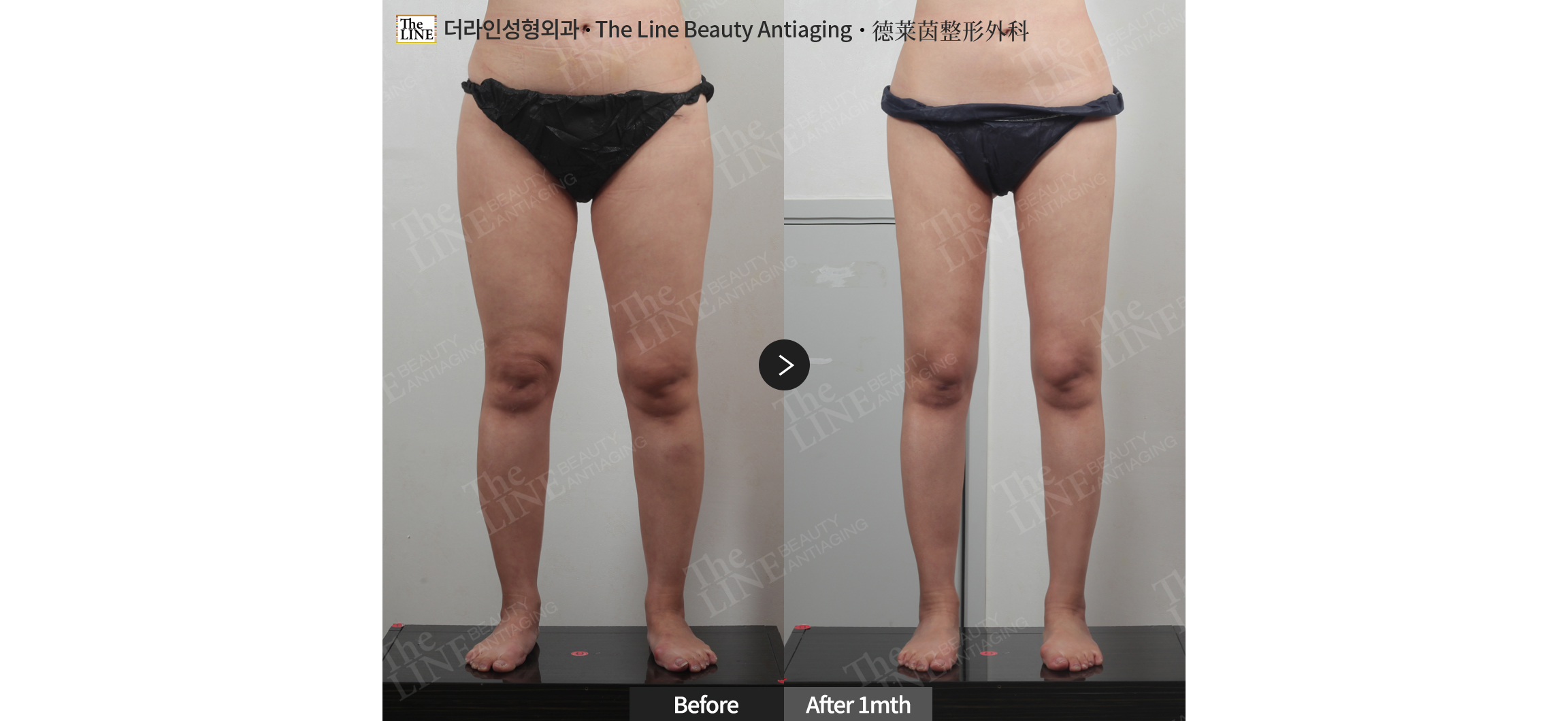 전사진