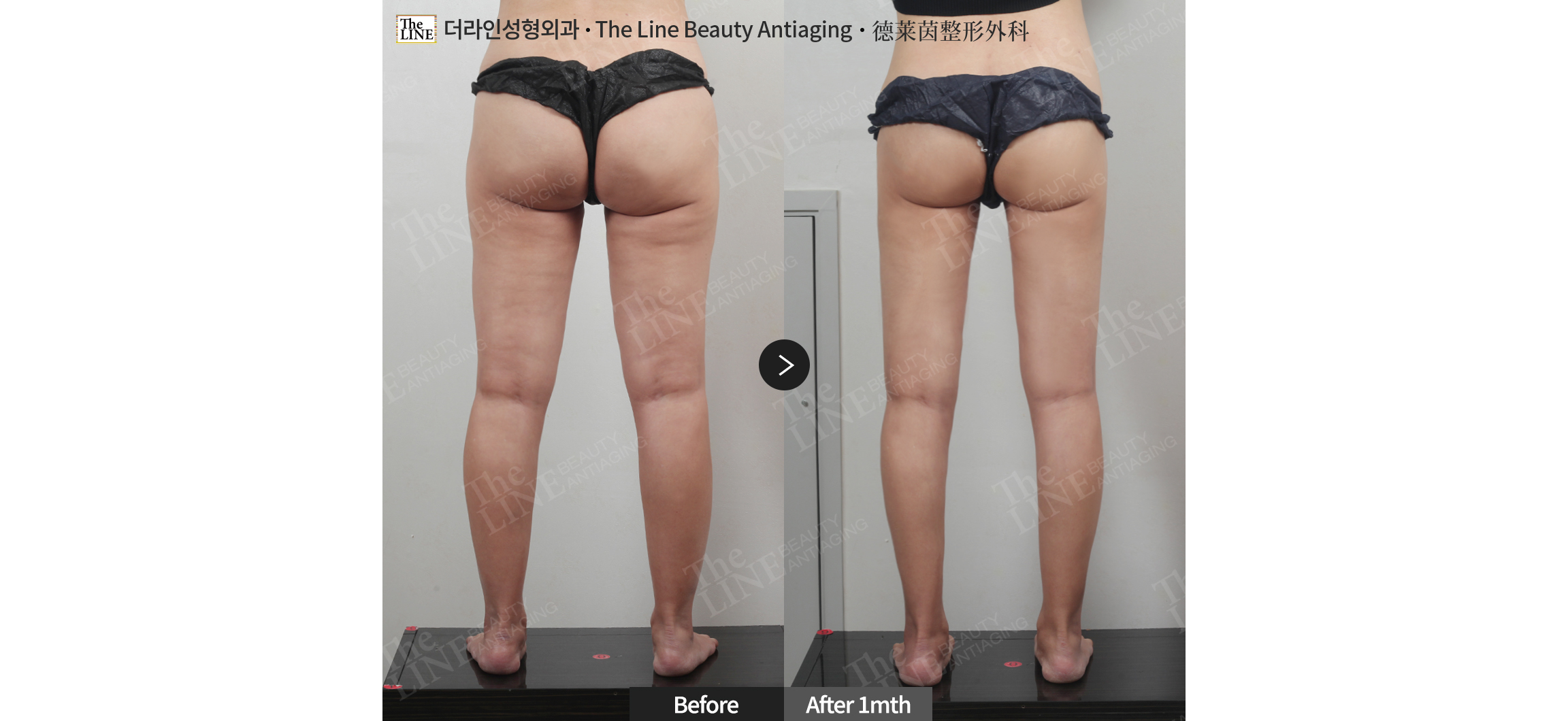 전사진