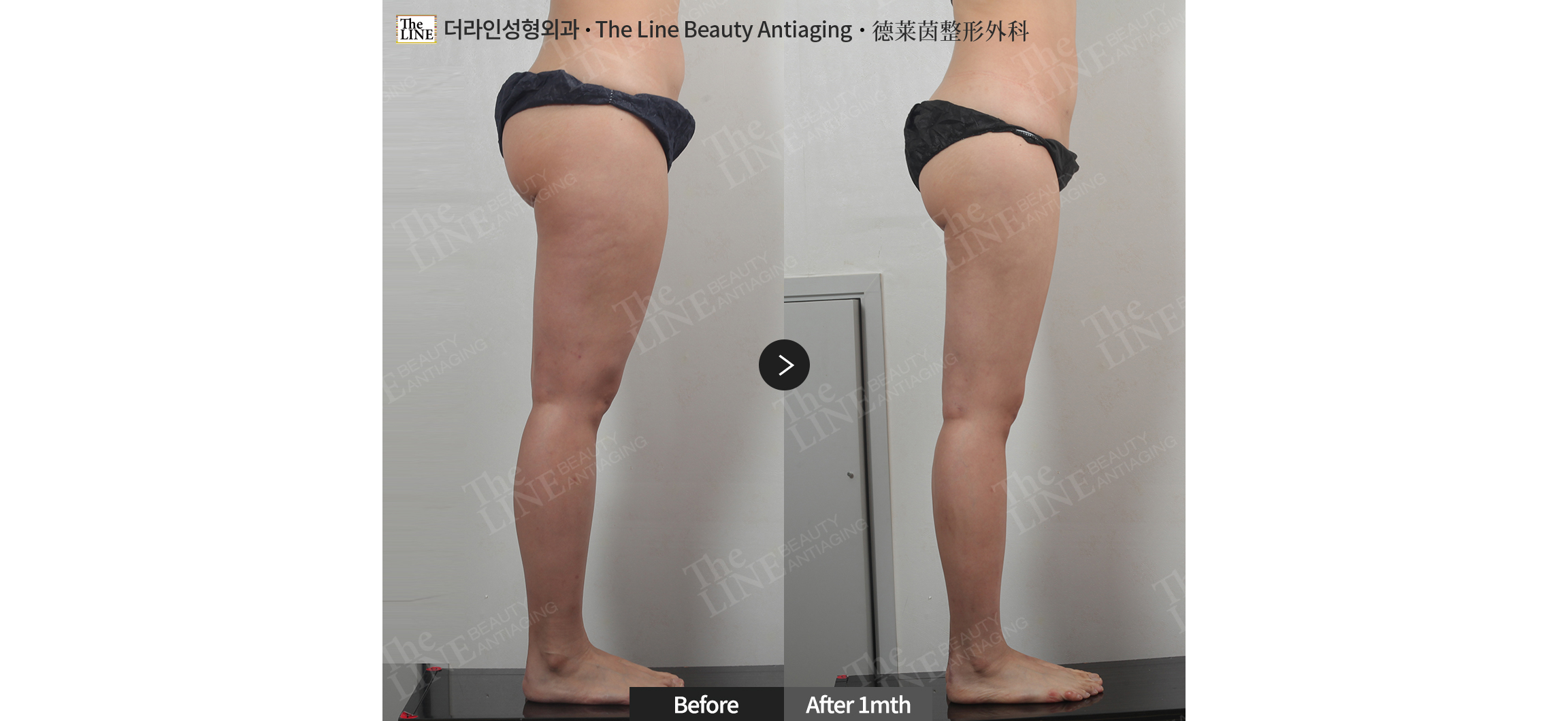 전사진