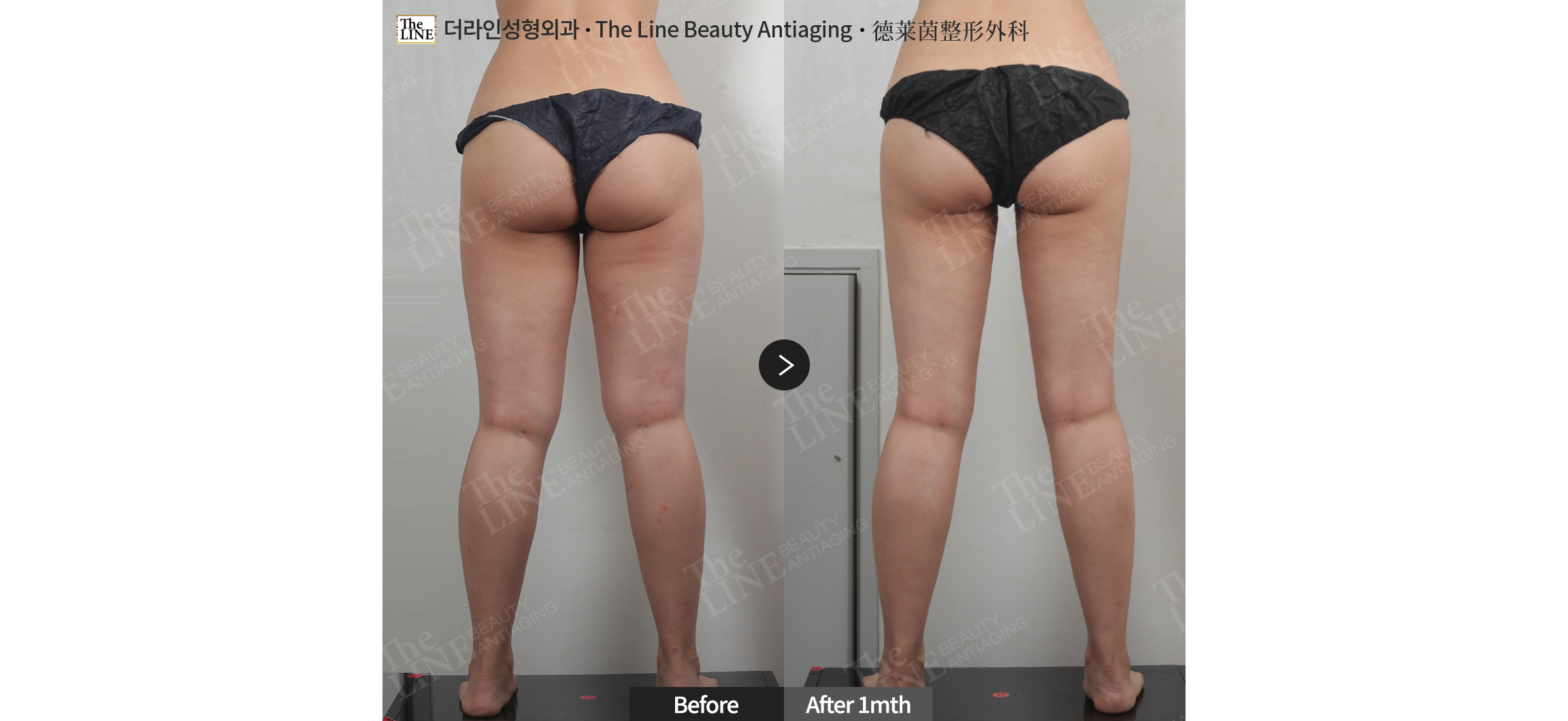 전사진