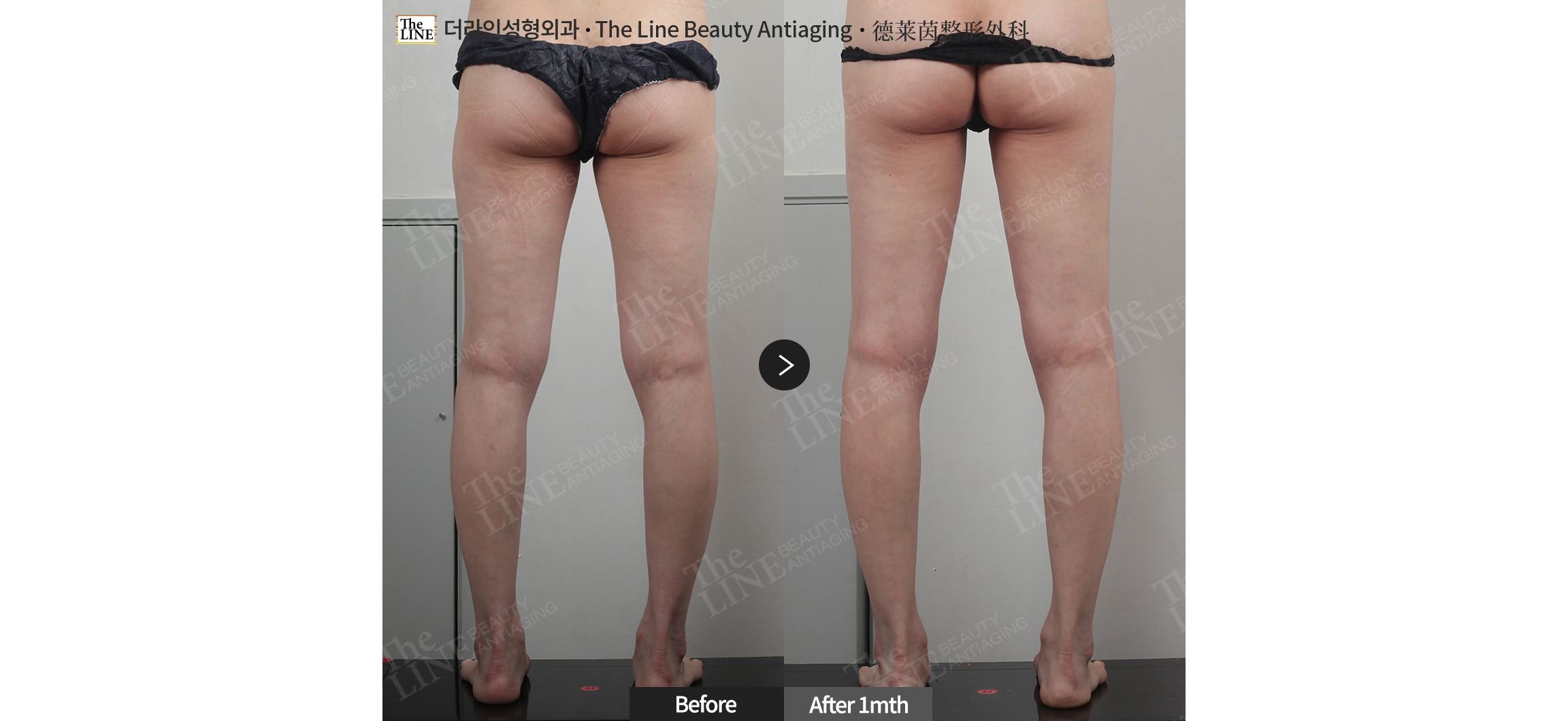 전사진