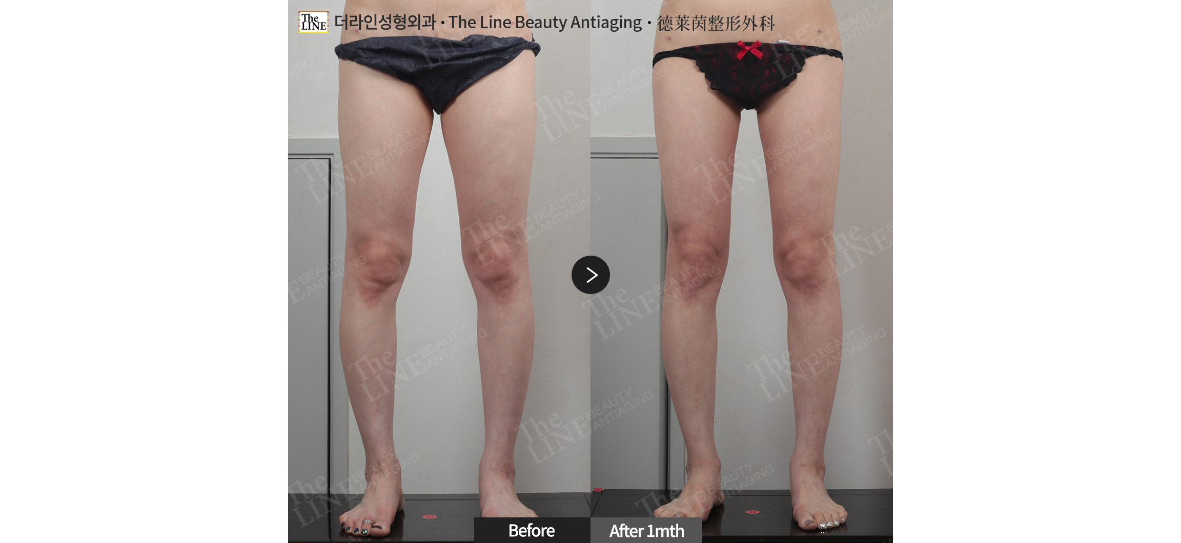 전사진