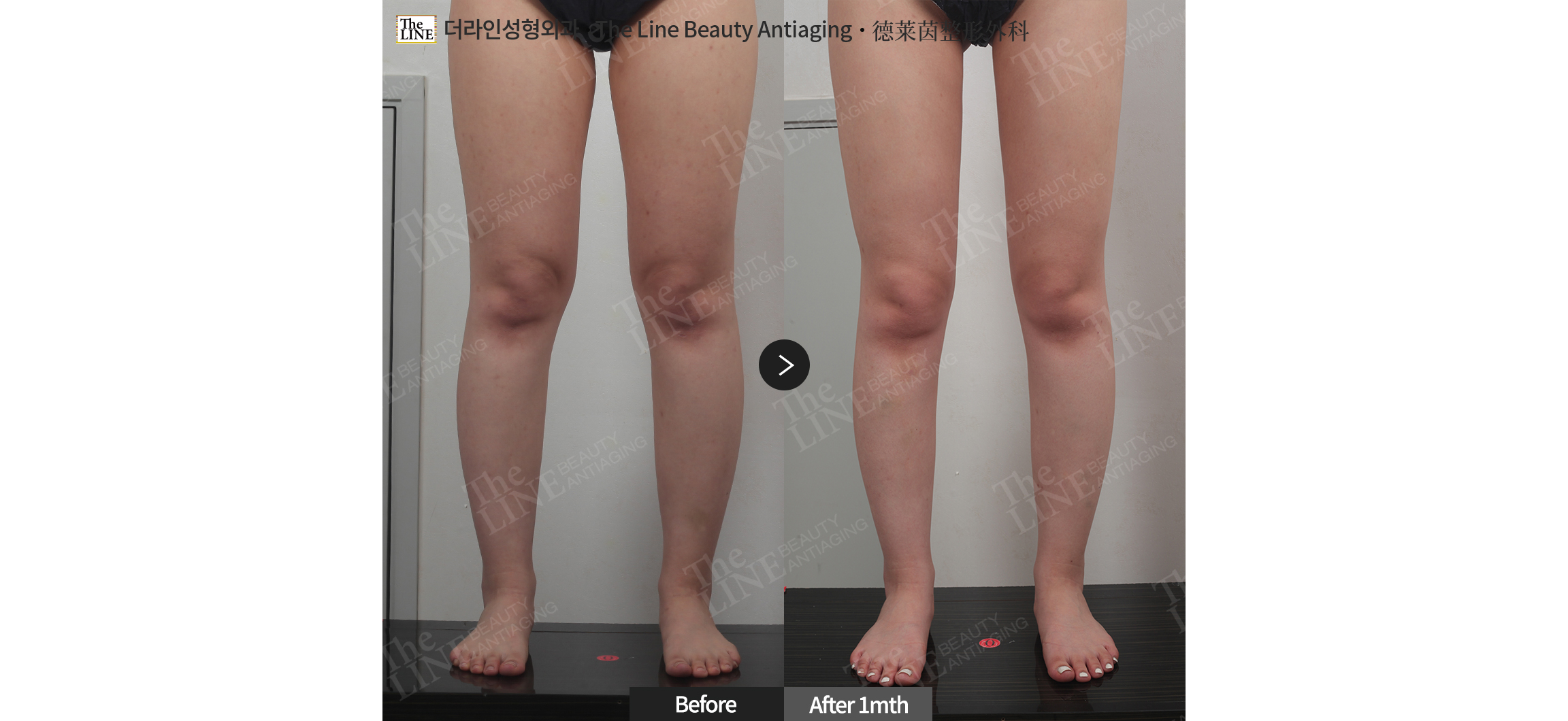 전사진
