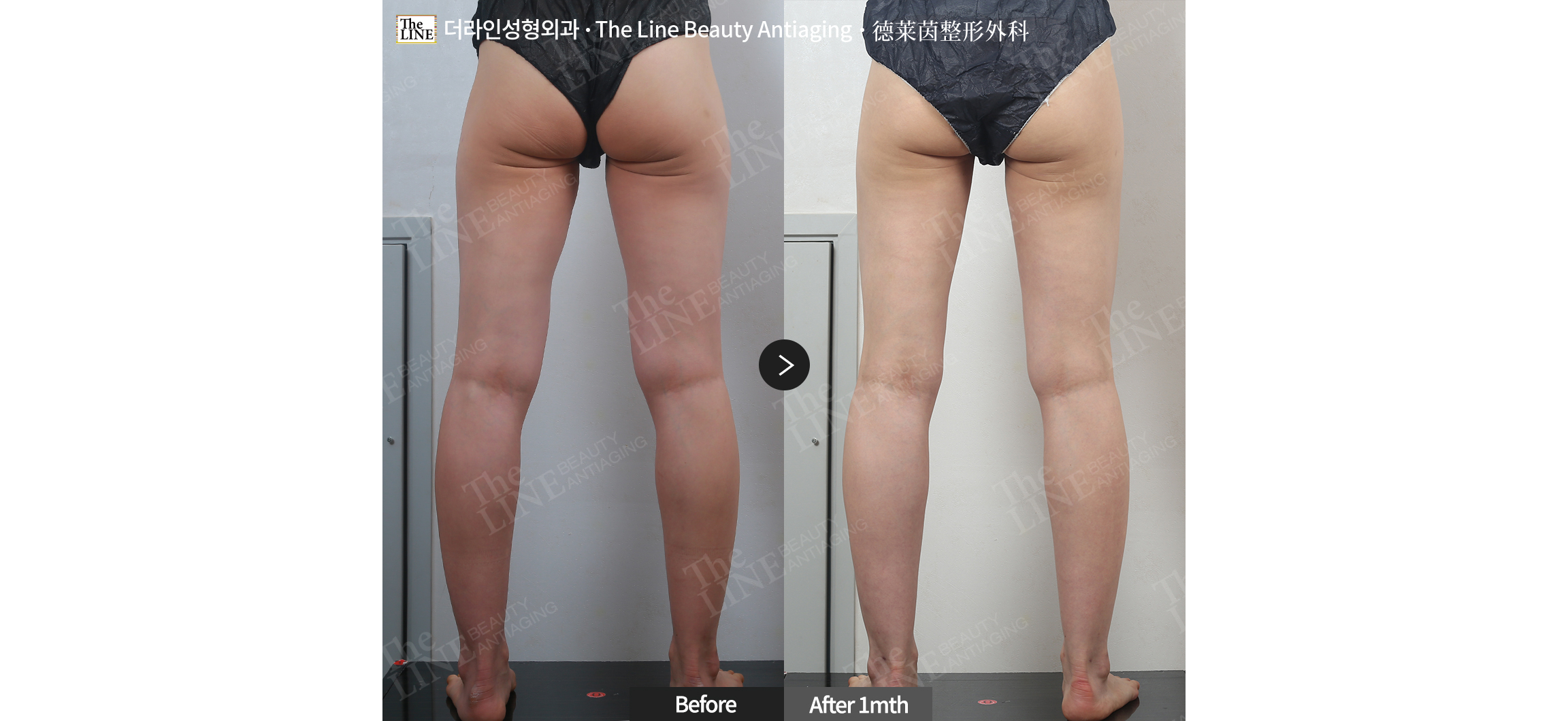 전사진