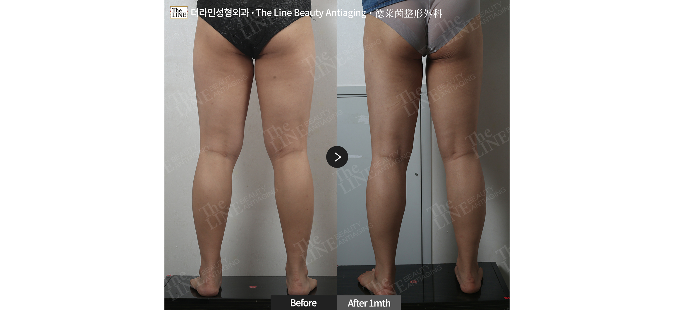전사진