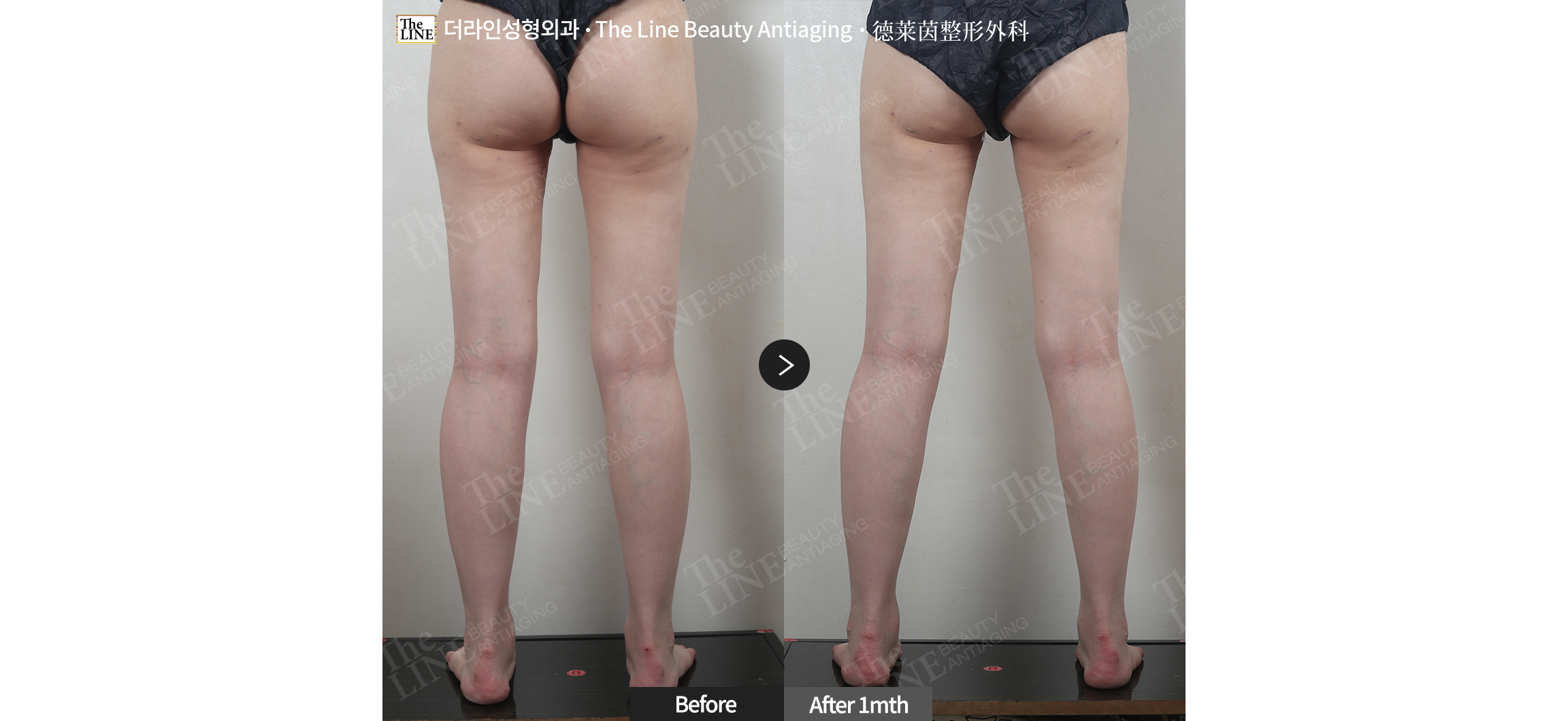 전사진