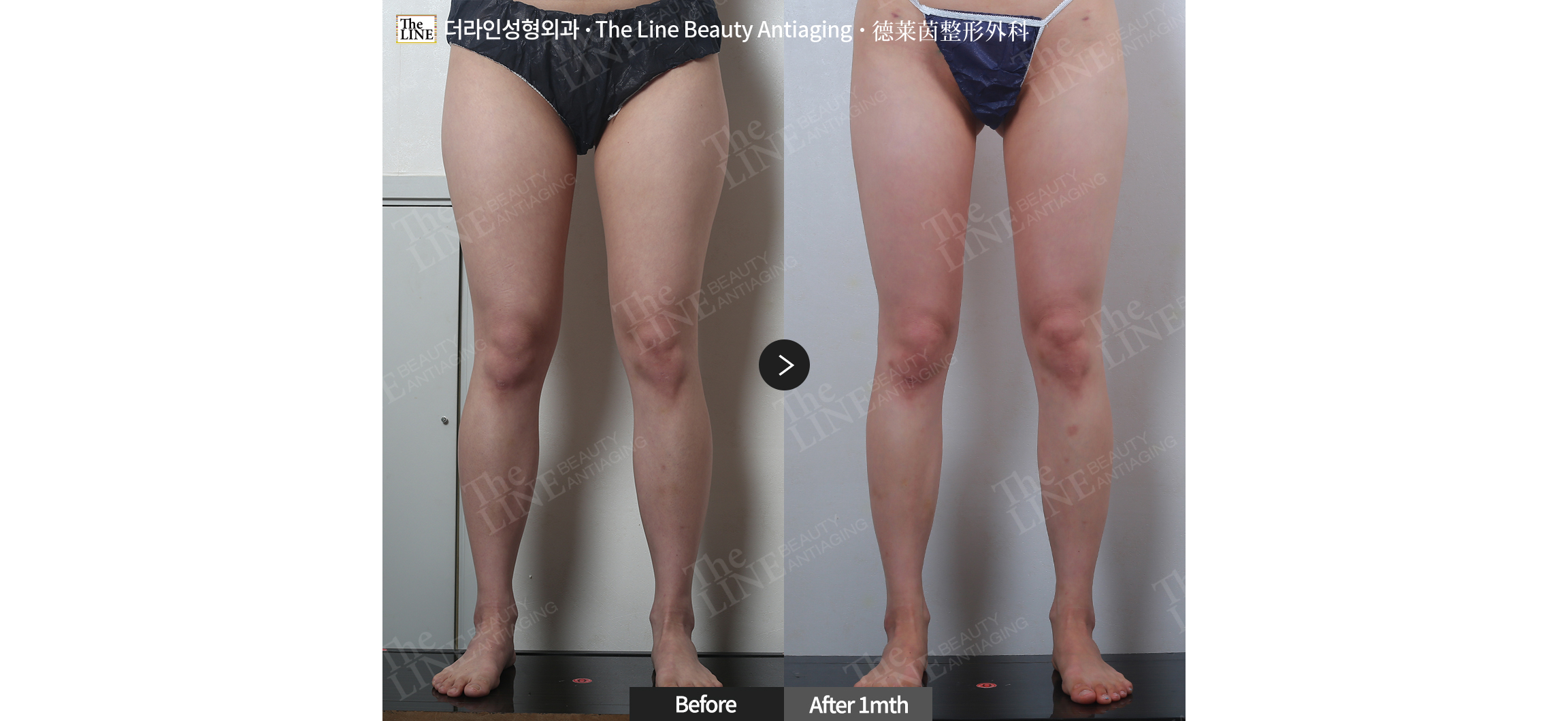 전사진