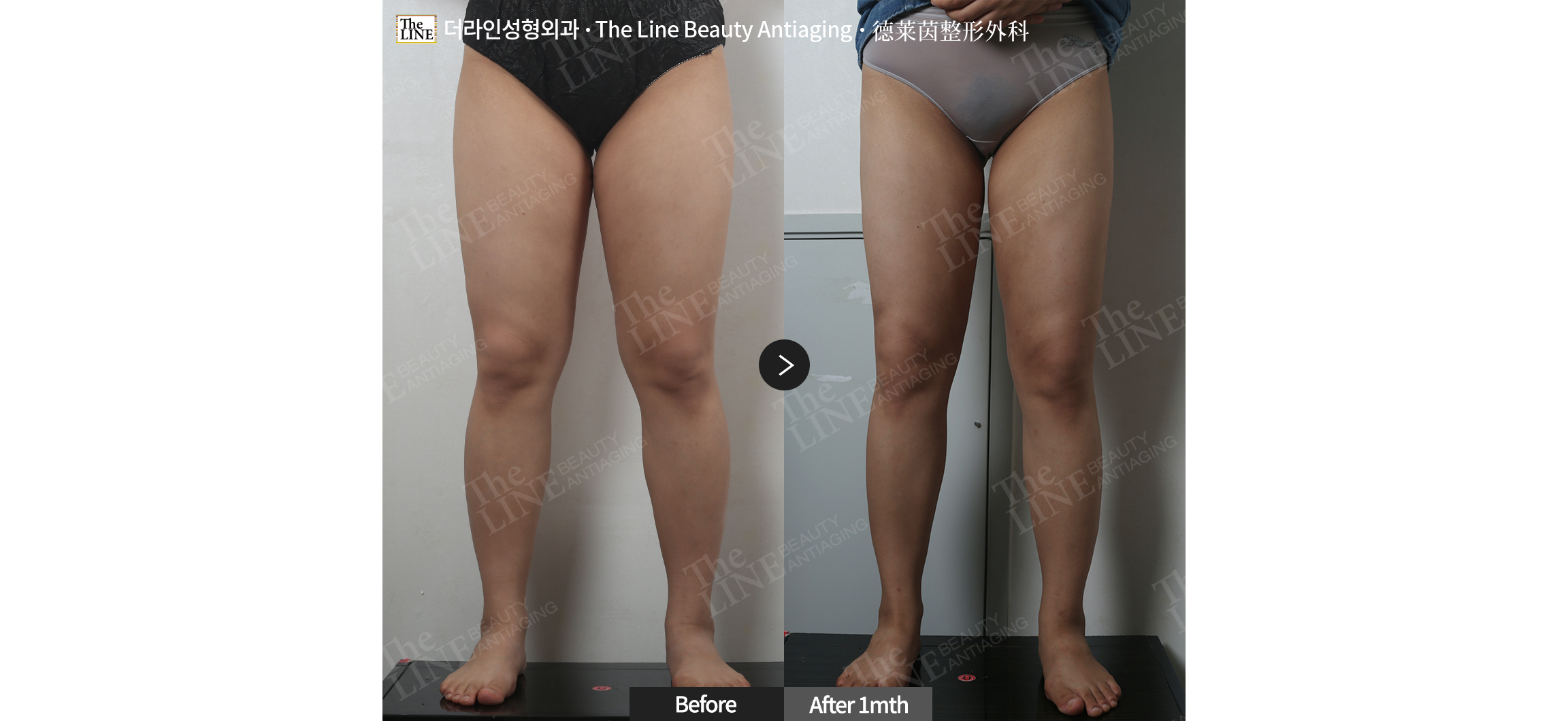 전사진
