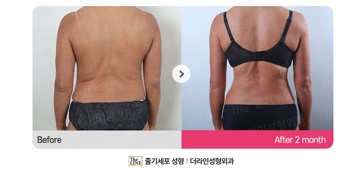 전사진