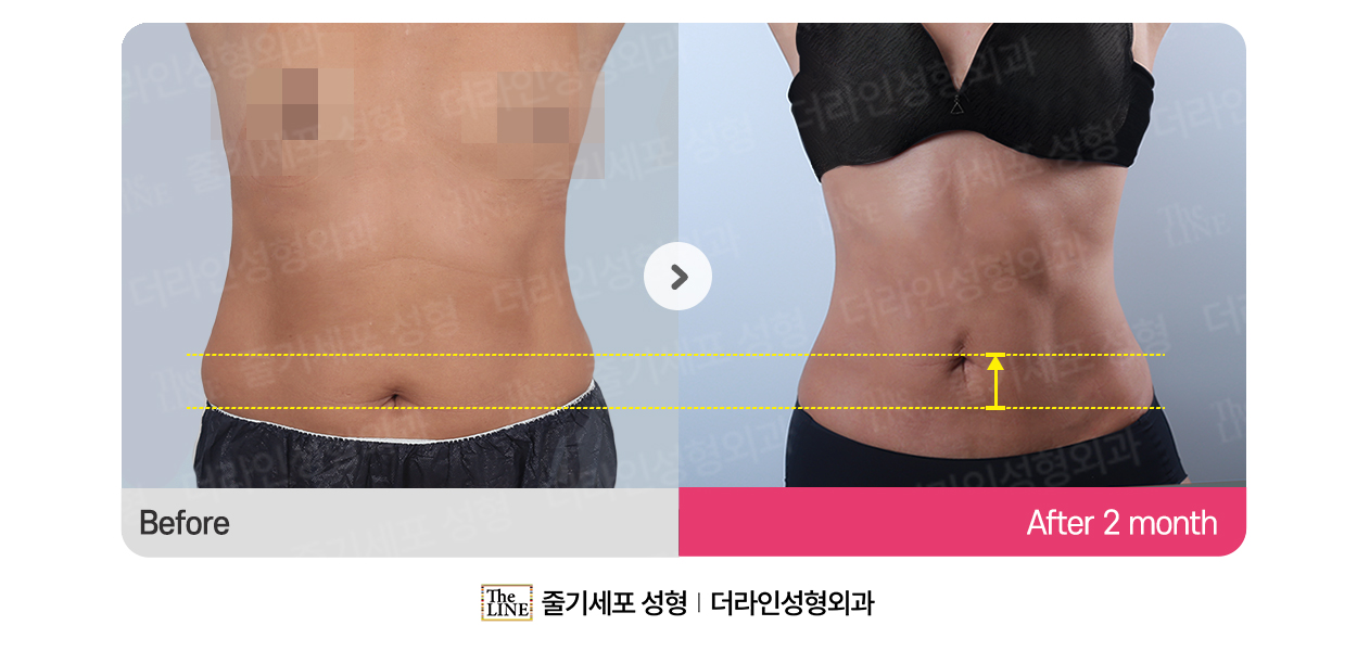 전사진