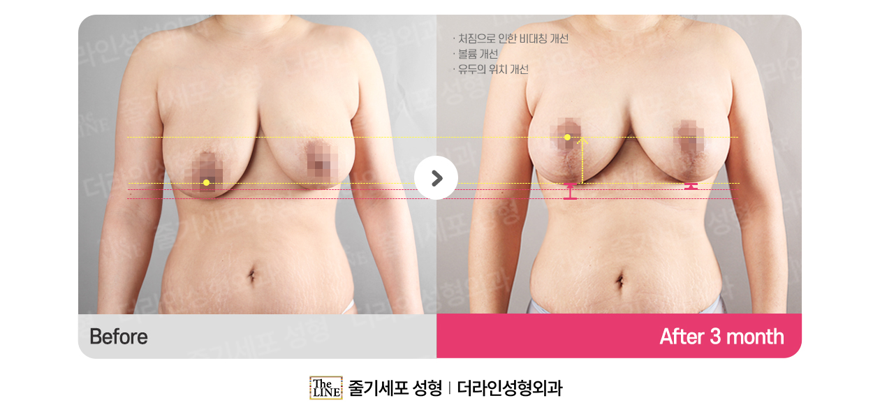 전사진