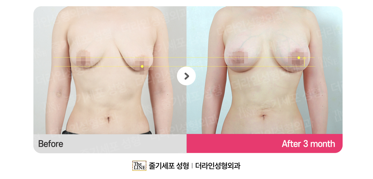 전사진