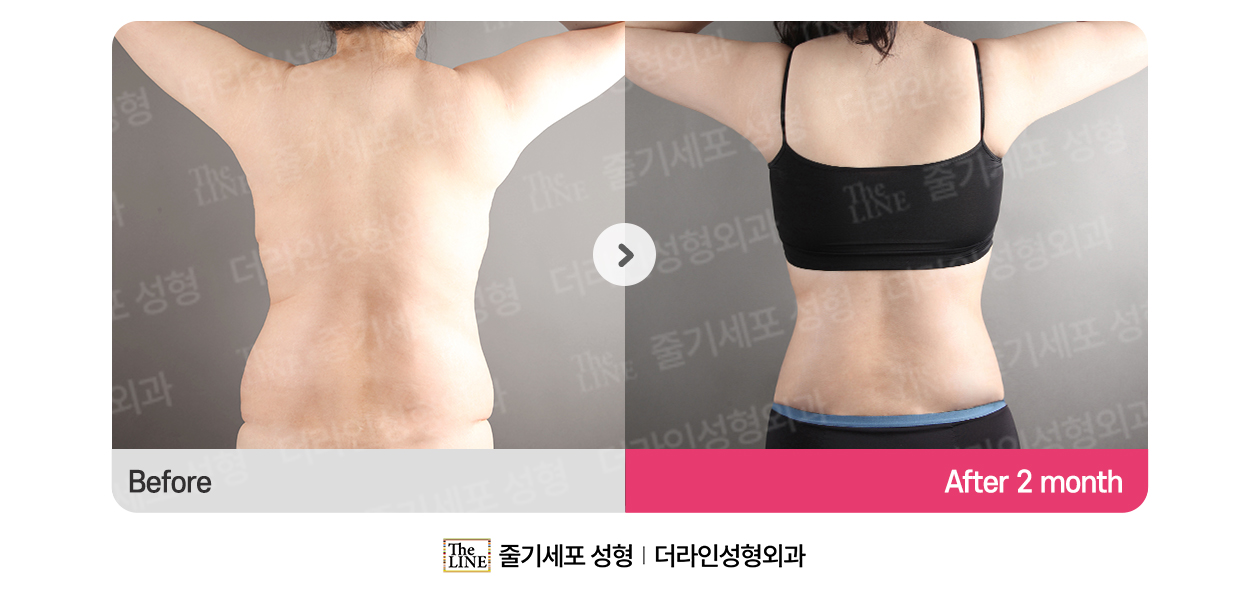 전사진