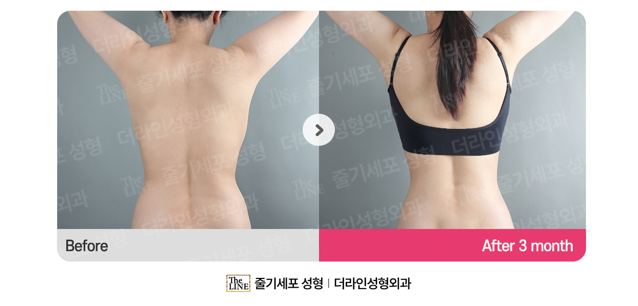 전사진