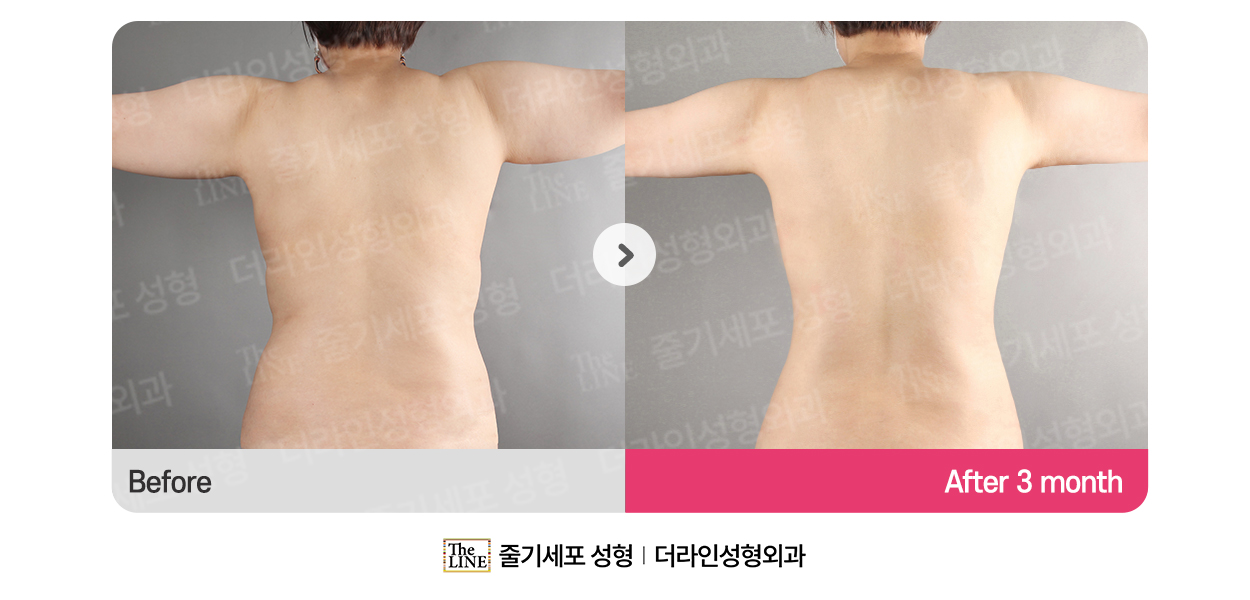 전사진