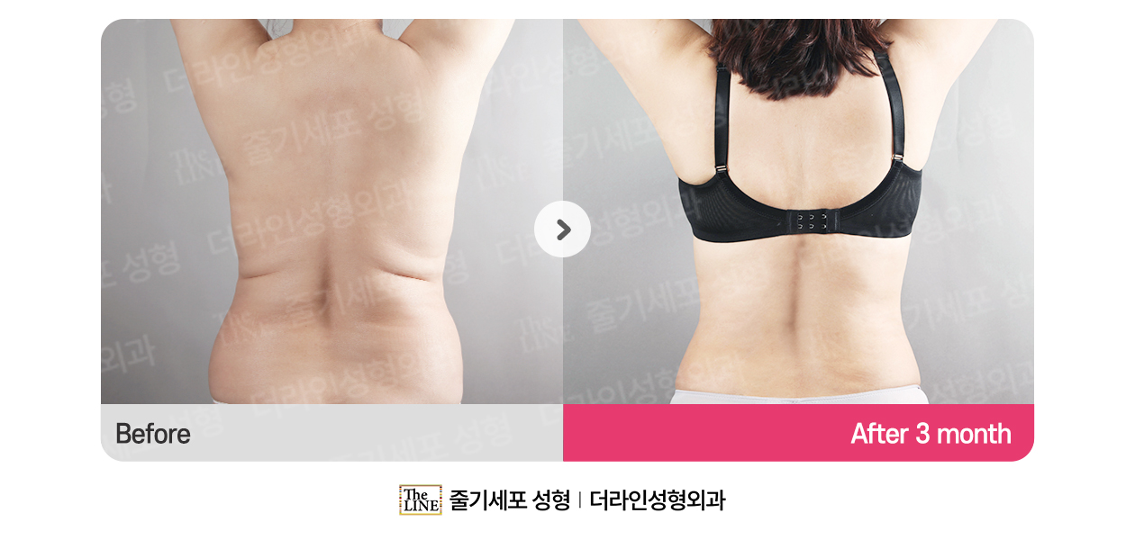 전사진