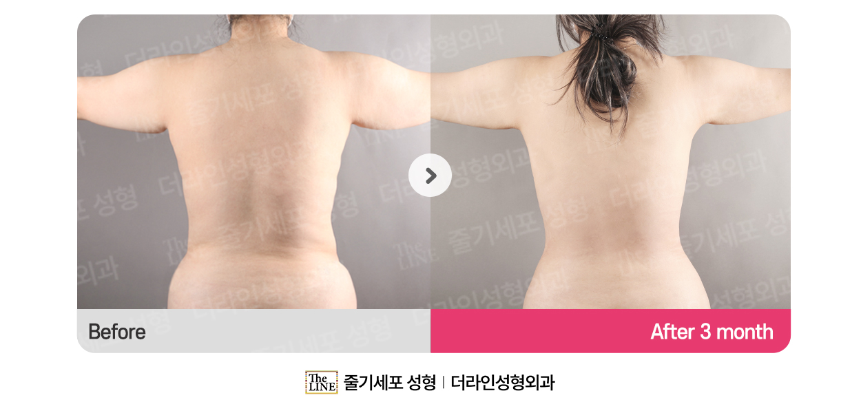 전사진