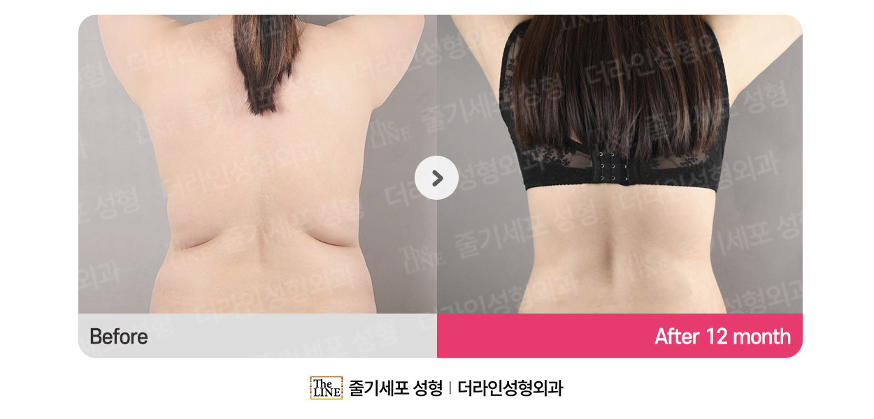 전사진