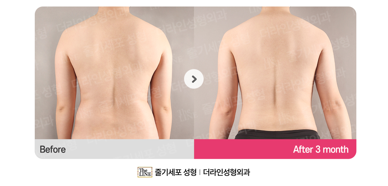 전사진