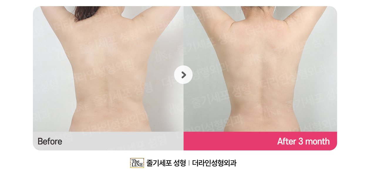 전사진
