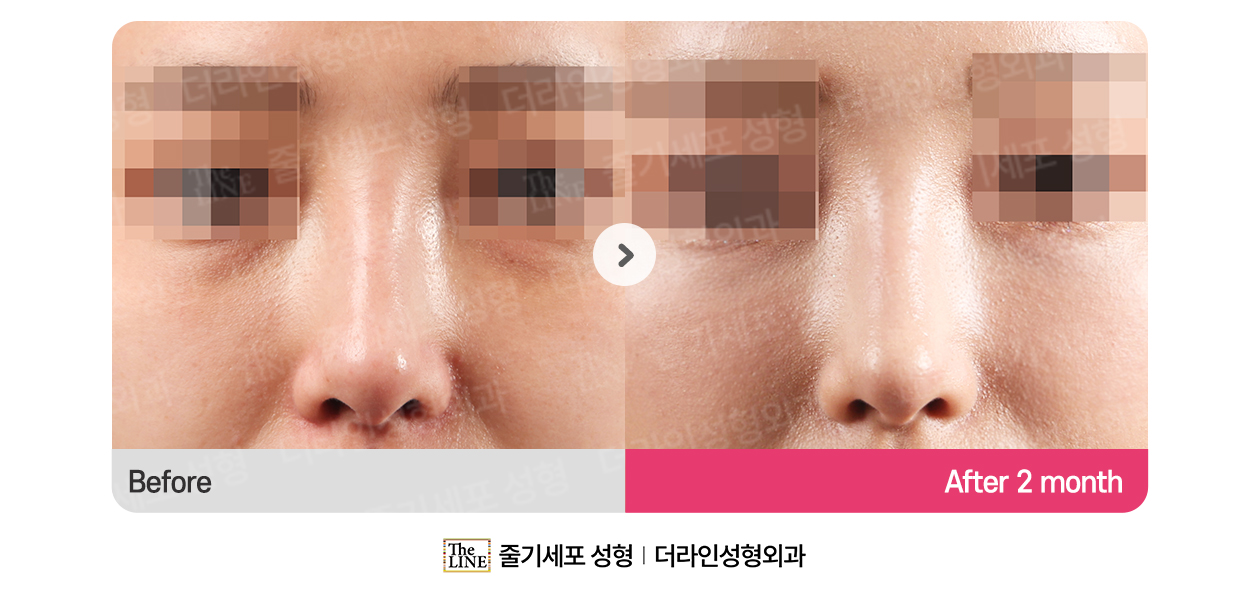 전사진