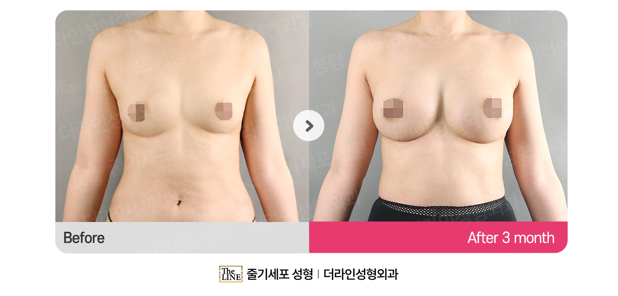 전사진