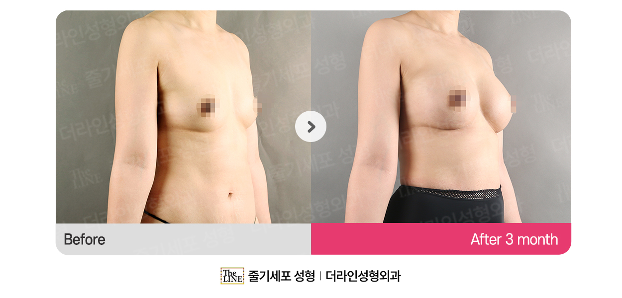 전사진