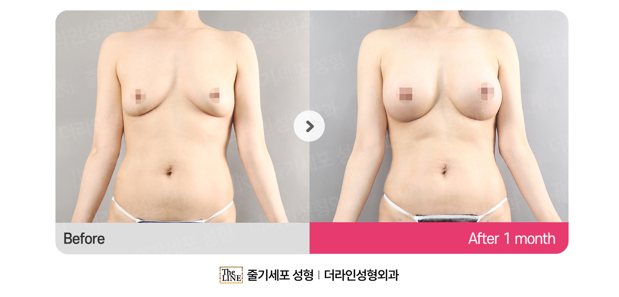 전사진