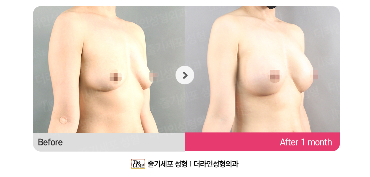 전사진