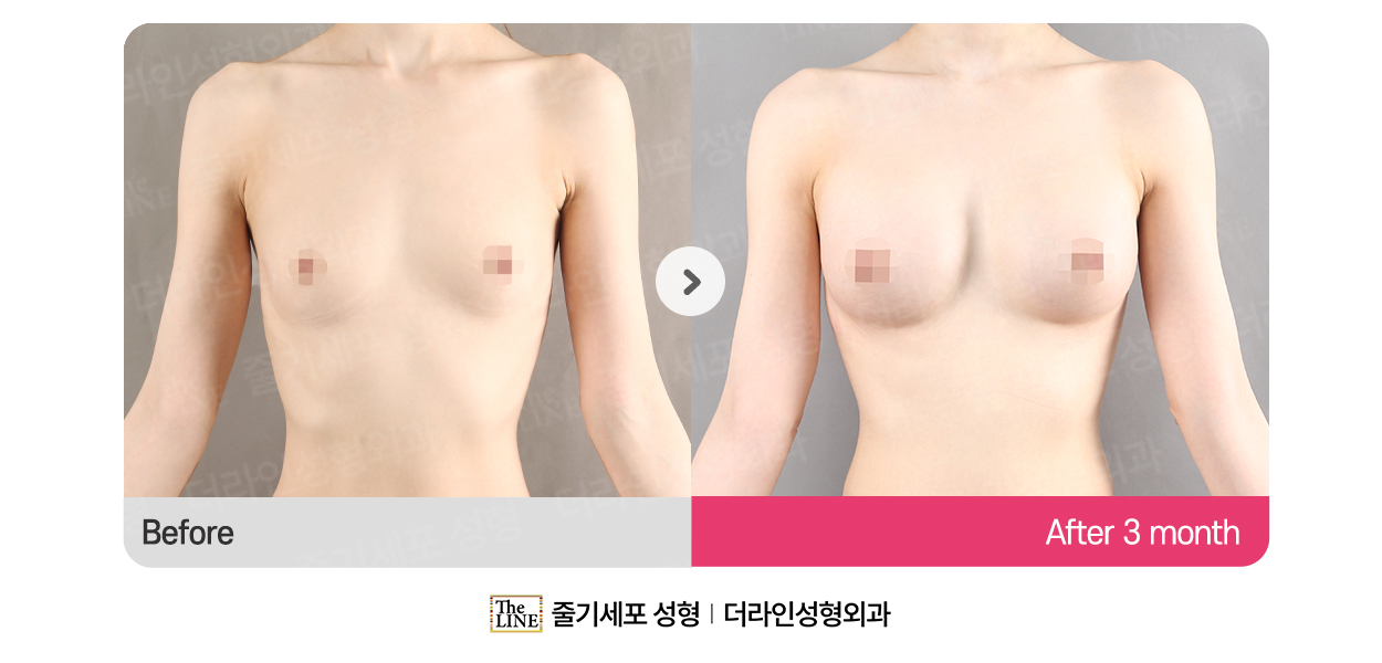 전사진