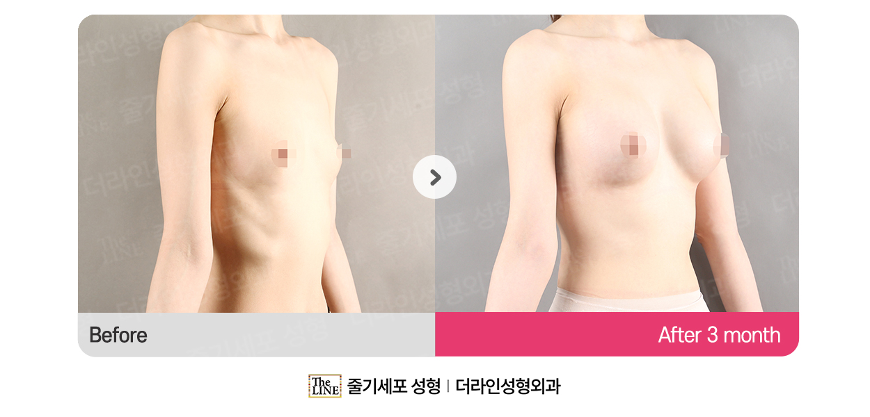 전사진