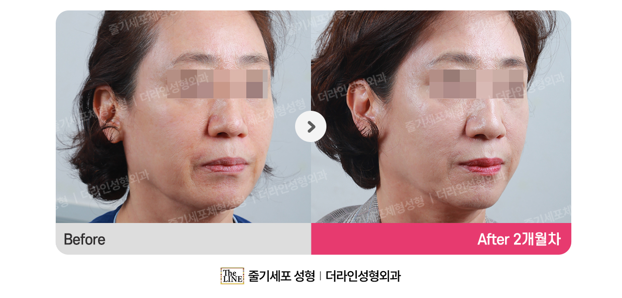 전사진