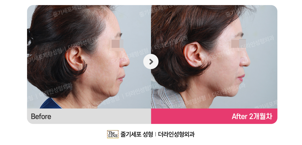 전사진