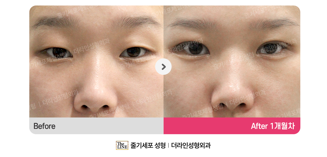 전사진