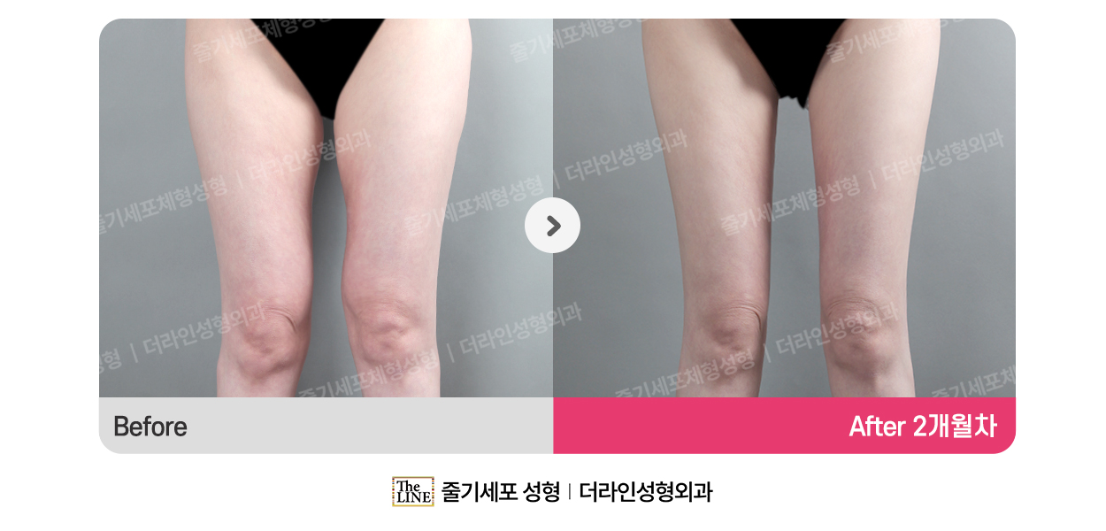 전사진