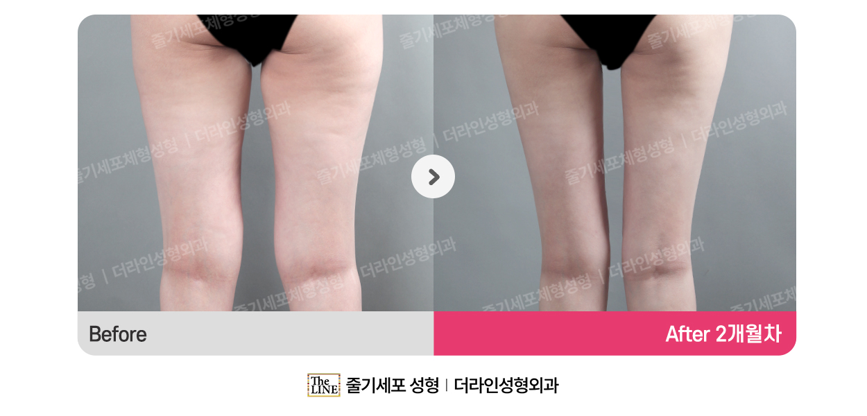 전사진