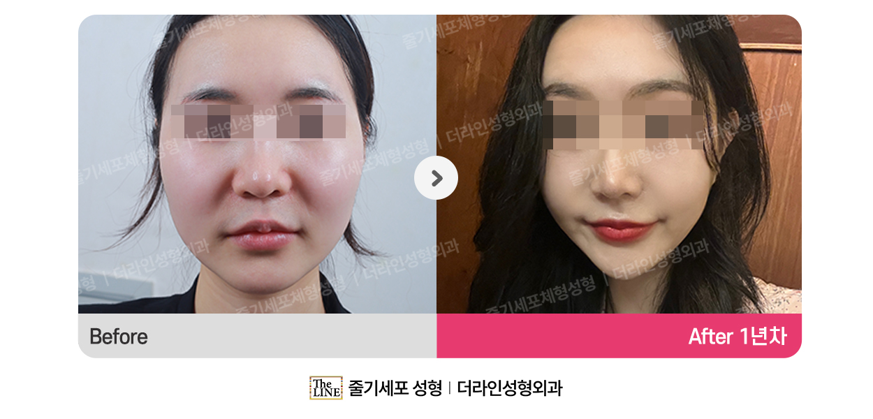 전사진