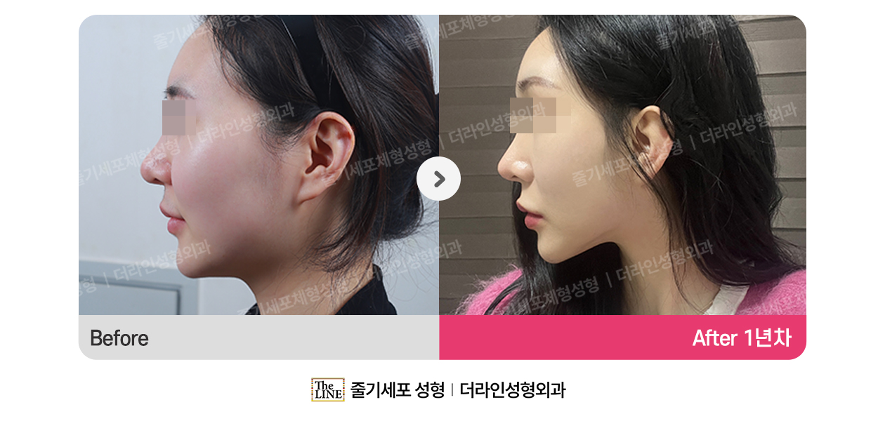 전사진