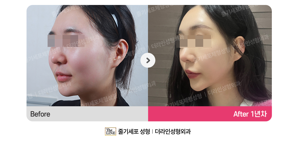 전사진
