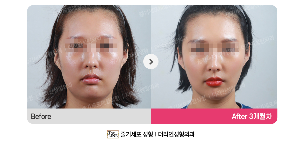 전사진