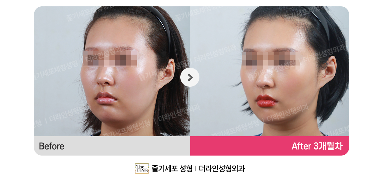 전사진