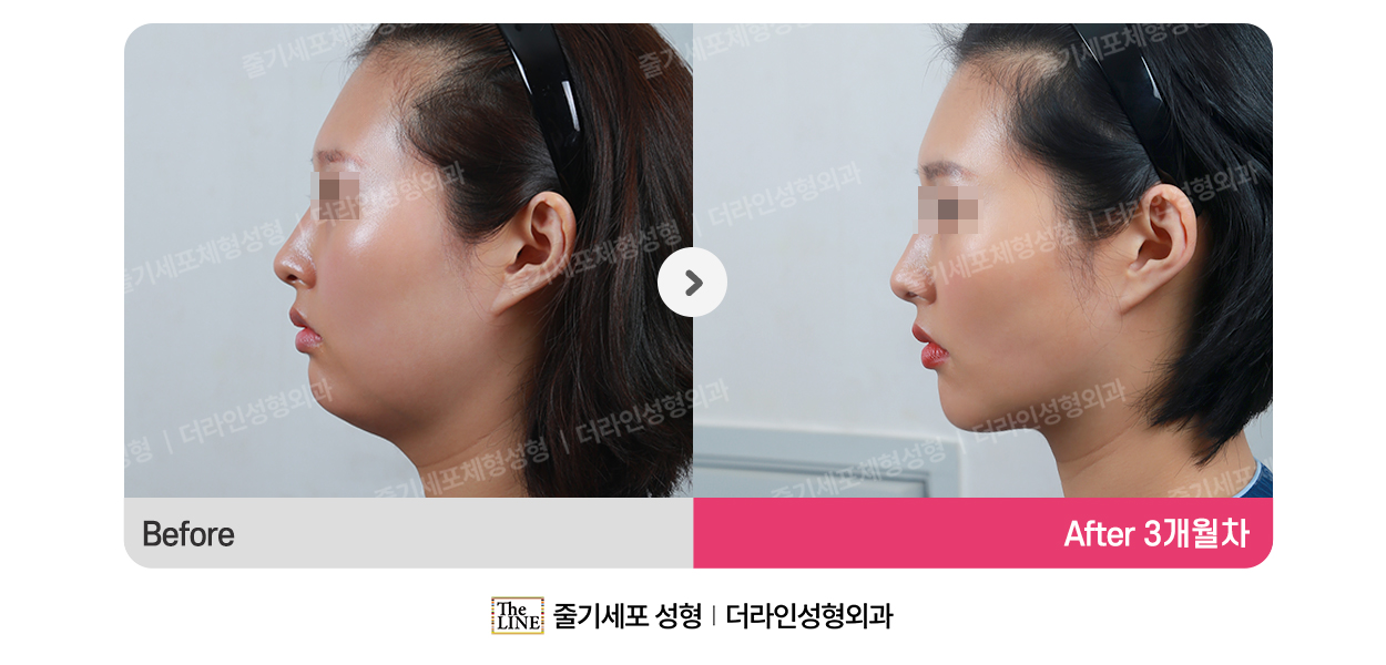 전사진