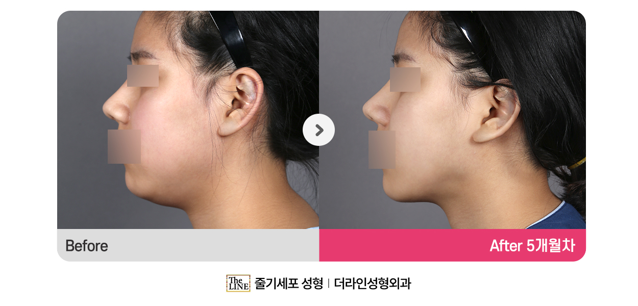 전사진