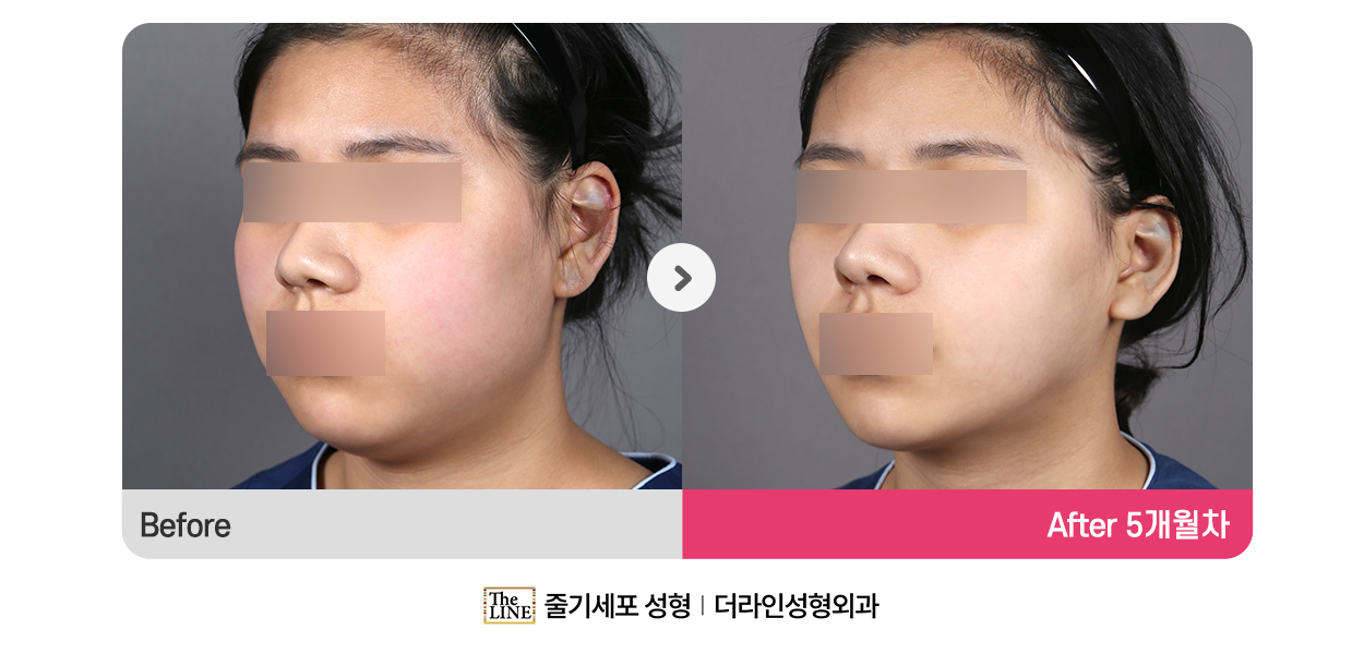 전사진