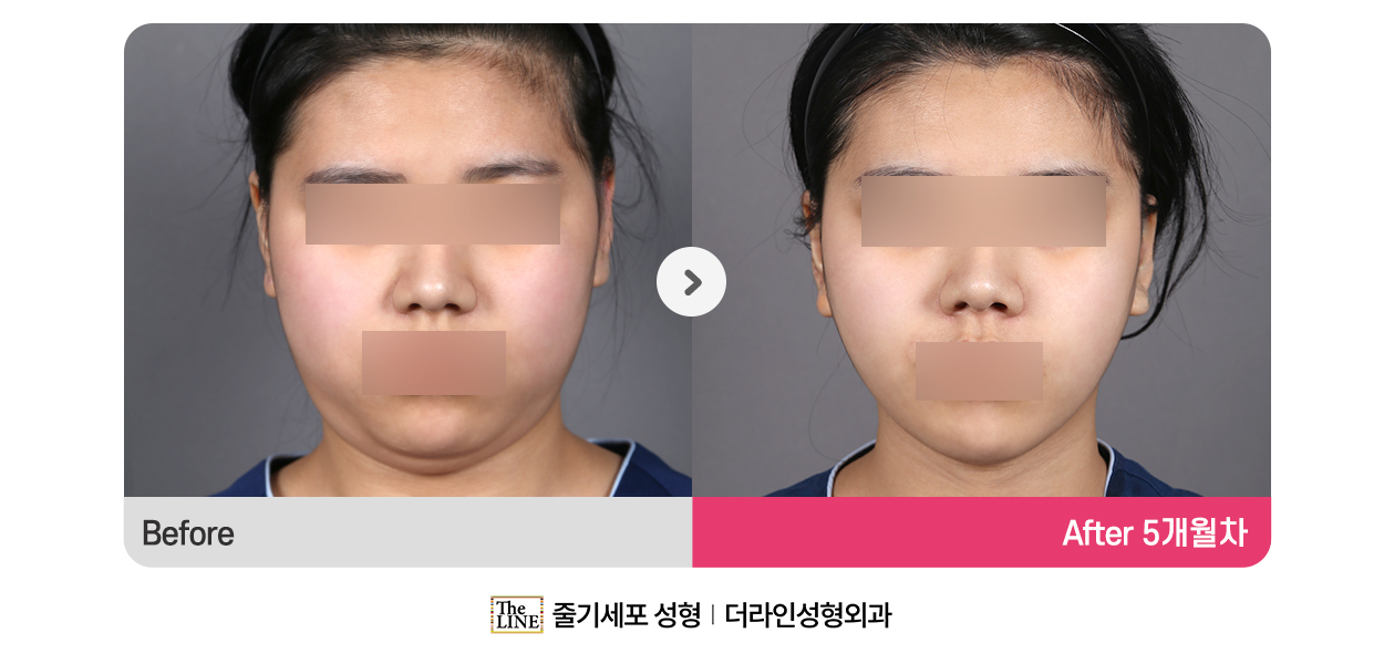 전사진