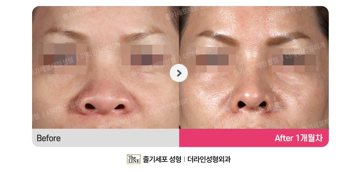 전사진