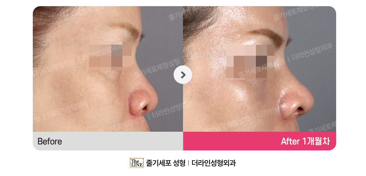 전사진