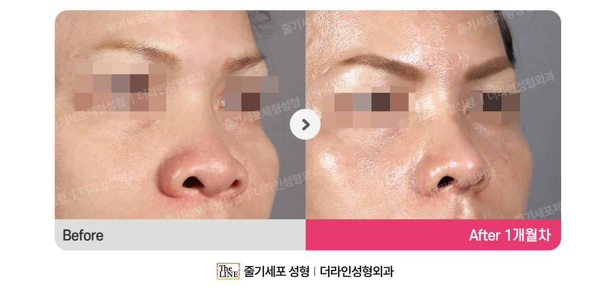 전사진