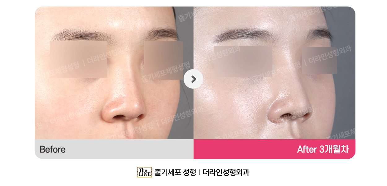 전사진